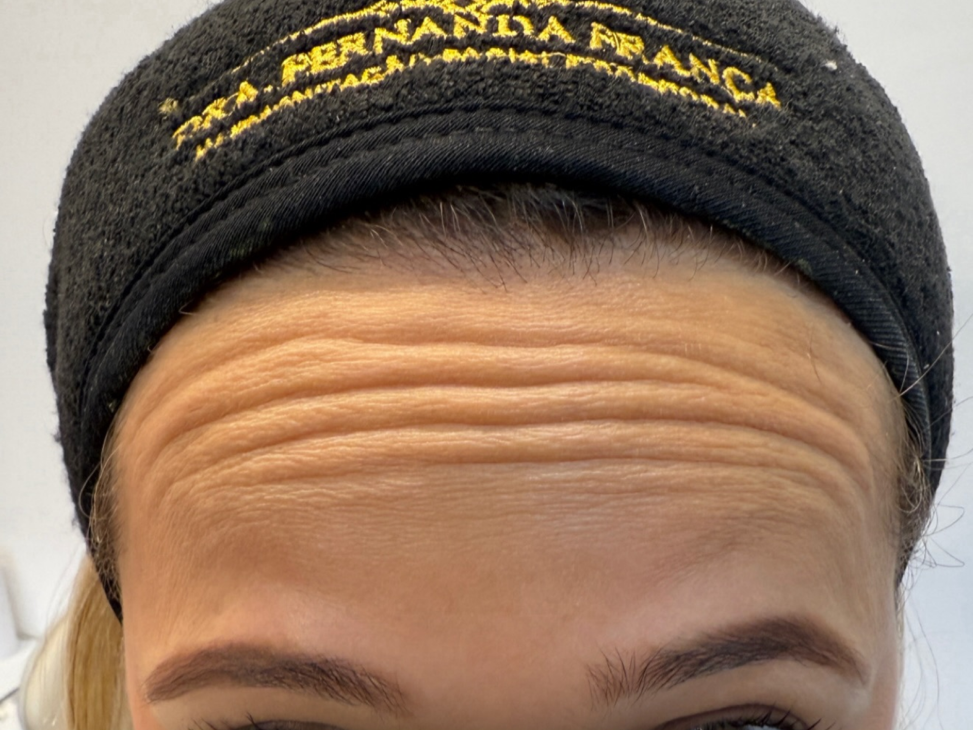 Antes Dra. Fernanda