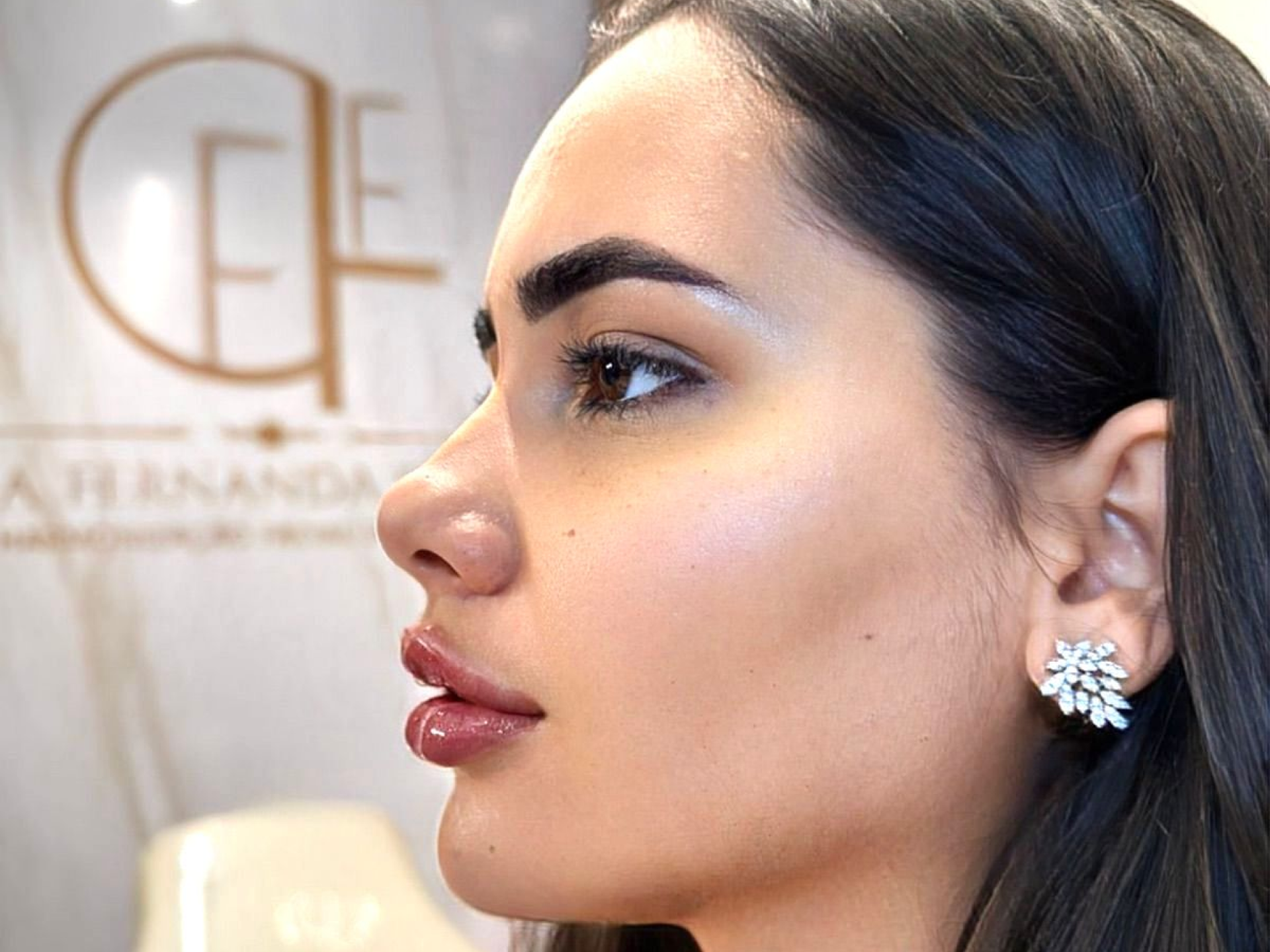 Resultado Face 1 - Antes e Depois