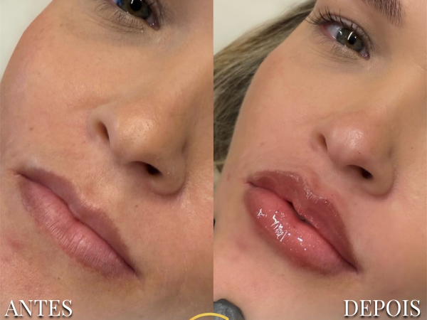 Resultado Dra. Fernanda 1