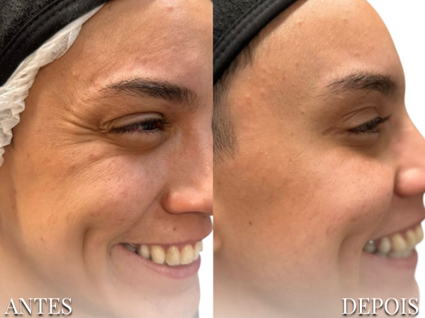 Resultado Dra. Fernanda 10