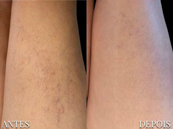 Resultado Dra. Fernanda 11