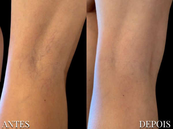 Resultado Dra. Fernanda 12