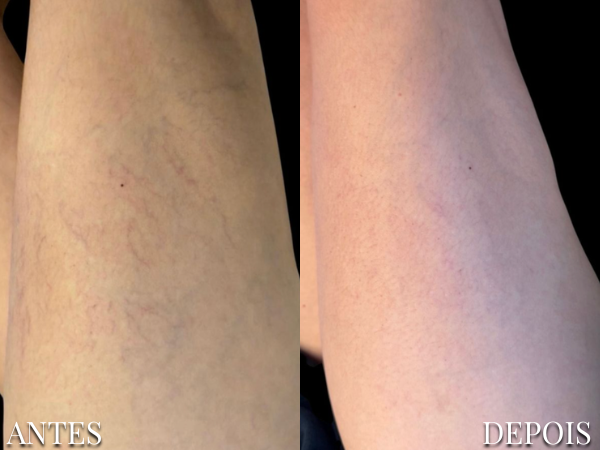 Resultado Dra. Fernanda 13