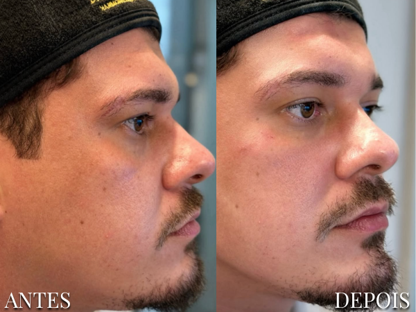 Resultado Dra. Fernanda 15