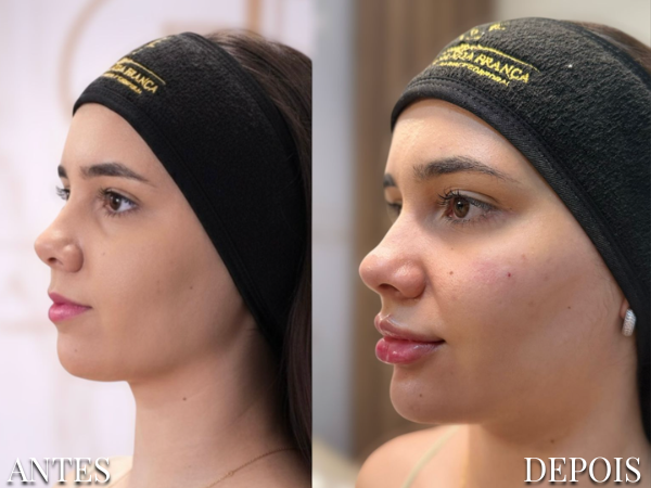 Resultado Dra. Fernanda 2