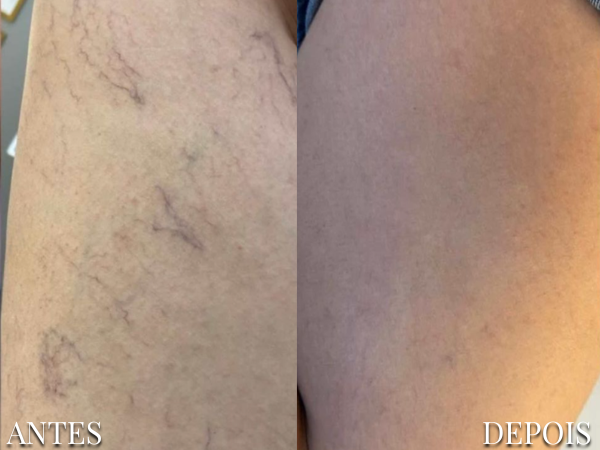 Resultado Dra. Fernanda 3