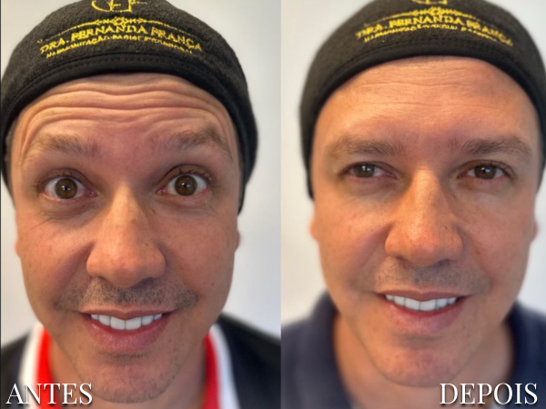 Resultado Dra. Fernanda 4