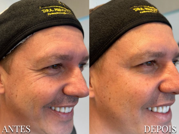 Resultado Dra. Fernanda 5