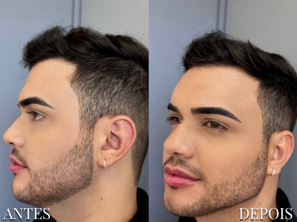 Resultado Dra. Fernanda 7