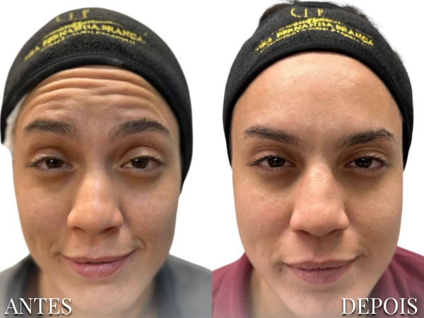 Resultado Dra. Fernanda 8