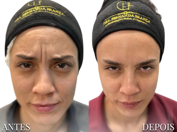 Resultado Dra. Fernanda 9